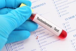 Men's Testosterone Test